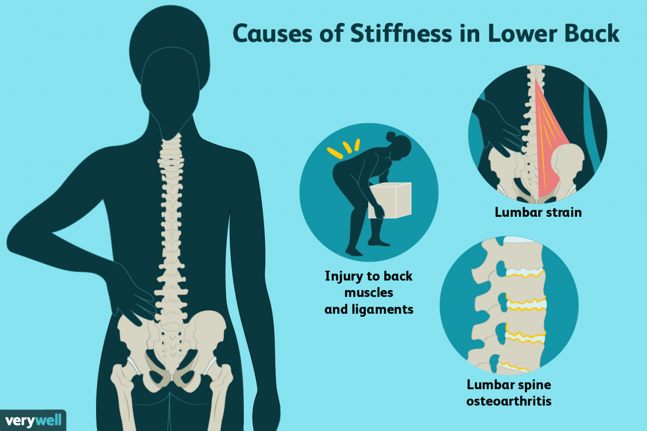 Pain lower back hip tight causes flexor cause flexors spine sitting muscle lordosis side psoas anatomy hips kyphosis number caused